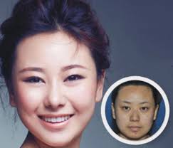 صور أنجح عمليات التجميل التي حصلت حتى الآن في العالم..فرق واضح ولكن طبيعي!  - بوابة الشروق - نسخة الموبايل