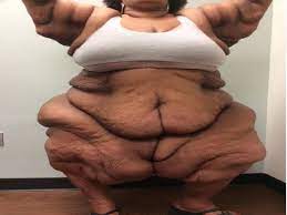 कभी थी दुनिया की सबसे मोटी महिला, घर से उठाने आया था बुलडोजर, 3 हाथी के  बच्चों जितना कम कर लिया वजन - Worlds fattest woman catrina raiford shares  transformation lost 3