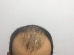 26 27 10 2016 3500 Greft Dr Zekeriya Kul
