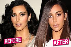 So, did kim k go under the knife? Secret Chin Nose Lips Surgery Kim K S Drastic Plastic Obsession Exposed