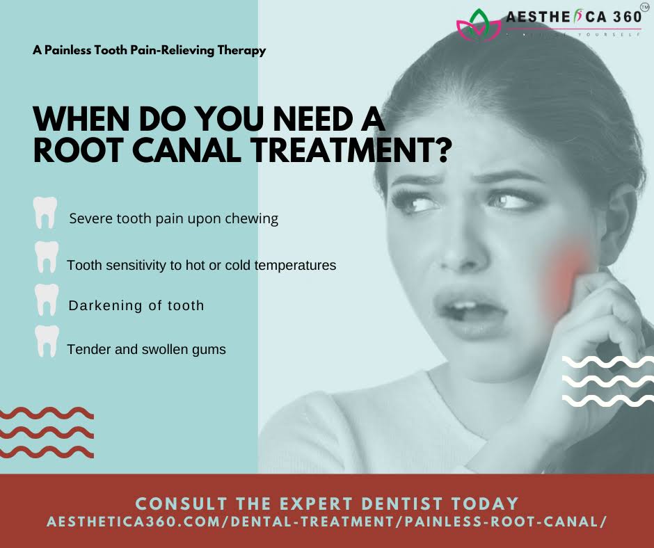 Root Canal Treatment (RCT) product image