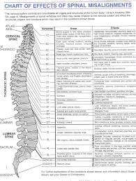 Chart Of Effects Of Spinal Misalignment Anatomy Spine