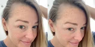 Cover postpartum bald spots with wigs or hats. Jamie Otis Shows Bald Spots From Postpartum Hair Loss On Instagram