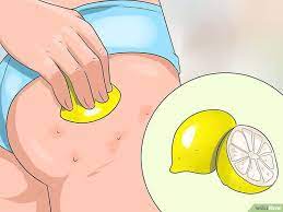 7 Ways To Get Rid Of Acne On The Buttocks Acne Scar Remedies Chest Acne Pimples On Buttocks