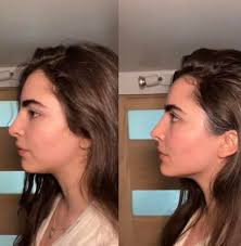 Give your eyes a tap massage: Tapping in a gentle circle around your  sockets and across your brows and cheekbones may encourage lymph drainage  and reduce inflammation by bringing blood to the