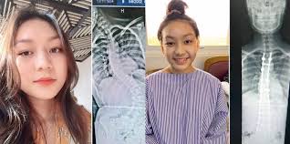 Mungkin anda perlu mulai mencoba cara ada banyak cara mengatasi sakit pinggang yang bisa dicoba, namun yang manakah cara terbaik. Lenguh Pinggang Kerap Tukar Posisi Tidur Susah Bernafas Derita Sakit Tulang Bengkok