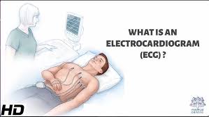 Image result for Electrocardiogram