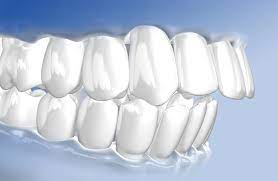 Haufige Fehlstellungen