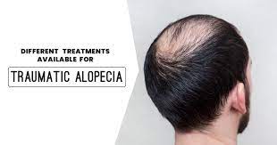 Any kind of physical trauma—surgery, a car accident, or a severe illness, even the flu—can cause temporary hair loss. Different Treatments Available For Traumatic Alopecia Hair And Skin Factory