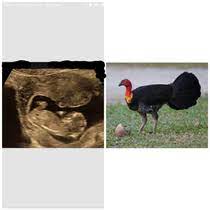 I Told My Friend Her Ultrasound Looks Like A Bush Turkey Meme Guy