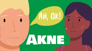 Seine vitalstoffe reinigen das blut und verbessern die. Akne Bekampfen So Bekommst Du Pickel In Den Griff Ah Ok Youtube