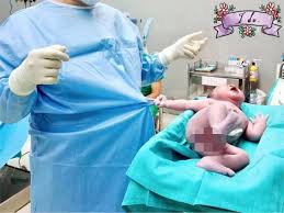 Just before it is born, was bought back to life by the scale of dr arthur smith, obstetrician at the margaret haig maternity hospital in jersey city, new jersey, usa. Newborn Baby Grabs Doctor S Shirt And Refuses To Let Go Moments After Being Born World News Mirror Online
