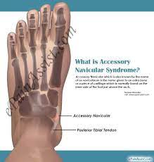 Pin On Joint Pain
