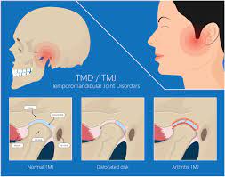 A tooth abscess can sometimes cause pain that radiates to the ear or jaw. Why Is My Jaw Popping And What Can I Do
