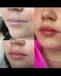 Ashley Guillory, RN (@ageless.with.ashley) • Instagram photos and videos