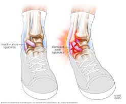 Other ligaments in the body include the: Ù…Ø¹Ù†Ù‰ Do You Like Ø¨Ø§Ù„Ø¹Ø±Ø¨ÙŠØ©