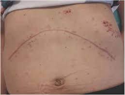 We did not find results for: Undiagnosed Pheochromocytoma Presenting As A Pancreatic Tumor A Case Report