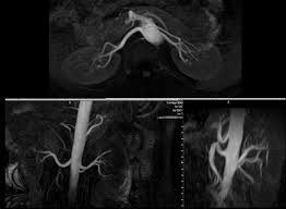 What happens after a head mri? Mri Scan Dubai Radiology Center Same Day Mri