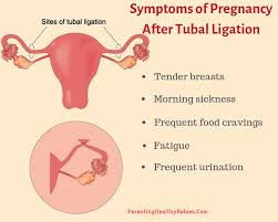 Parentingbabies On Twitter Tubal Ligation Is A Method Of Sterilization Among Women Who Do Not Want To Have Kids It Is Also Known As Getting The Tubes Tied Here Are Some Common