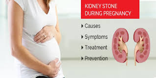Kidney Stone During Pregnancy Causes Symptoms Treatment Prevention Rg Stone Hospital
