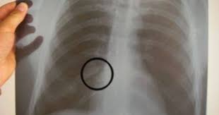 Pin On While I M Recovering