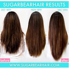The Ultimate Sugar Bear Hair Review All You Need To Know About The Popular Hair Vitamins Sugar Bear Hair Vitamins Sugar Bear Hair Vitamins For Hair Loss