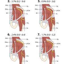 The lateral cutaneous nerve of the thigh (also called the lateral femoral cutaneous nerve) is a cutaneous nerve that innervates the skin on the lateral part of the thigh. Types Of Exits Of The Lateral Femoral Cutaneous Nerve From The Pelvis Download Scientific Diagram