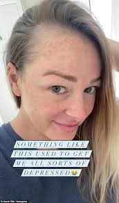 Even better, there are ways to treat it. Married At First Sight Star Jamie Otis Speaks Out About Postpartum Hair Loss Showbiz Readsector