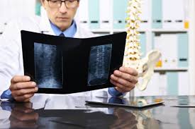 Spinal Fusion Coding Identify The Type Of Bone Graft Used For Fusion