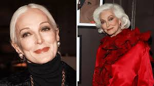 La modelo brasileña, Stephanie Yashimura de 28 años rompe estereotipos de  belleza al mostrar con orgullo su vitíligo en redes sociales