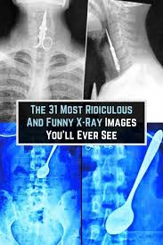 The 31 Most Ridiculous And Funny X Ray Images You Ll Ever See In 2020 Fun Facts History Nerd X Ray Images