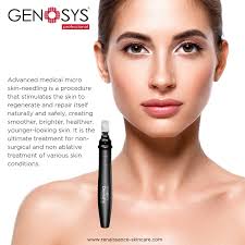 While transdermal application is the most popular use of microneedles, intraocular and intracochlear microneedle drug delivery systems are emerging. Genosys Microneedling Azure Beauty Salon