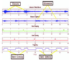 Applicants can apply earlier in the admissions timeline and receive an admission decision earlier on in the process. Emg Signals With Emg Triggered Status Download Scientific Diagram
