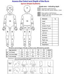 56 Prototypic Hot Water Burn Chart