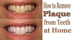 Jun 15, 2019 · step 1: How To Remove Plaque From Teeth Naturally Arxiusarquitectura