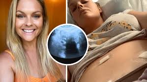 Heartbreaking revelation: Home And Away actress diagnosed with terminal  cancer