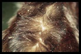 Image result for what do Cheyletiella look like in dog fur