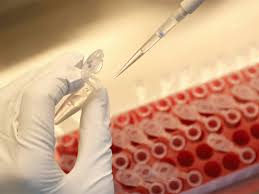11 things you need to know. Covid Vaccine No Need For Vaccines Covid Effectively Over Ex Pfizer Vp Health News Et Healthworld