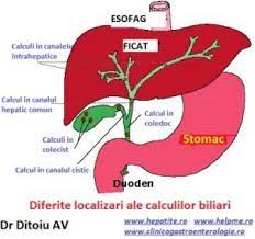 Atat pentru copii cat si pentru adulti, primul pas al regimului pentru prevenirea si tratarea regim pentru probleme biliare (fiere, colici biliare, sdr dispeptic biliar). Regimul Alimentar In Caz De Litiaza Biliara Dr Ditoiu Specialist Gastroenterologie Si Hepatologie