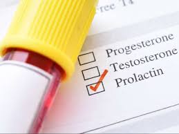Prolactin Level Test High Levels Low Levels And When To