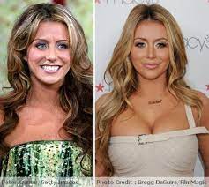 I think the worst comment i ever read — and then i didn't read any more — was 'she looks like an old leather handbag that's been put in the . Aubrey O Day Plastic Surgery Before After Celebrity Plastic Surgery Plastic Surgery Photos Plastic Surgery