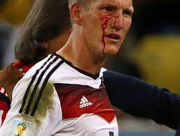 Bastian schweinsteiger, im gespräch bei: Photo Bastian Schweinsteiger Left Bleeding After Knock From Sergio Aguero Thescore Com