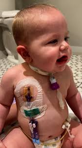 Here’s a little joy first thing in the morning. 🥹 We haven’t heard his  sweet giggle in SEVEN months. This was so precious. His sister got him  laughing! 💛, Please continue praying he continues to get ...