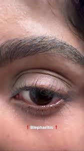 Image result for Blepharis sol