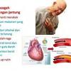 Jeruk memiliki kandungan pektin yang mampu mencegah stroke istemik yang disebabkan oleh penyumbatan. 1