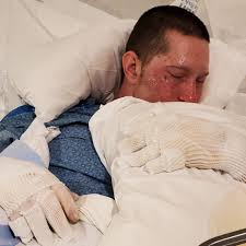 Fundraiser by Amanda Richardt : Dylan Burge support while in the burn unit