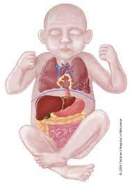 Cpam is listed in the world's largest and most authoritative dictionary database of abbreviations and acronyms. Congenital Pulmonary Airway Malformation Cpam Children S Wisconsin