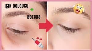 Isik Dolgusu Ve Botoks Yaptirdim 10bin Bakimi Youtube