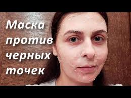 как убрать черные точки на лице в домашних условиях видео Maska Ot Chernyh Tochek Na Lice Soda I Sol Ot Chernyh Tochek Youtube