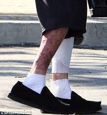 We did not find results for: Brave Travis Barker Ventures Out For The First Time Since Surviving Fatal Plane Crash Daily Mail Online